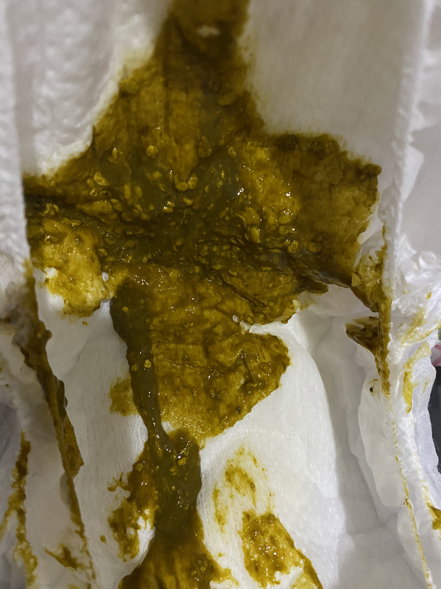 腹泻奶粉第21天