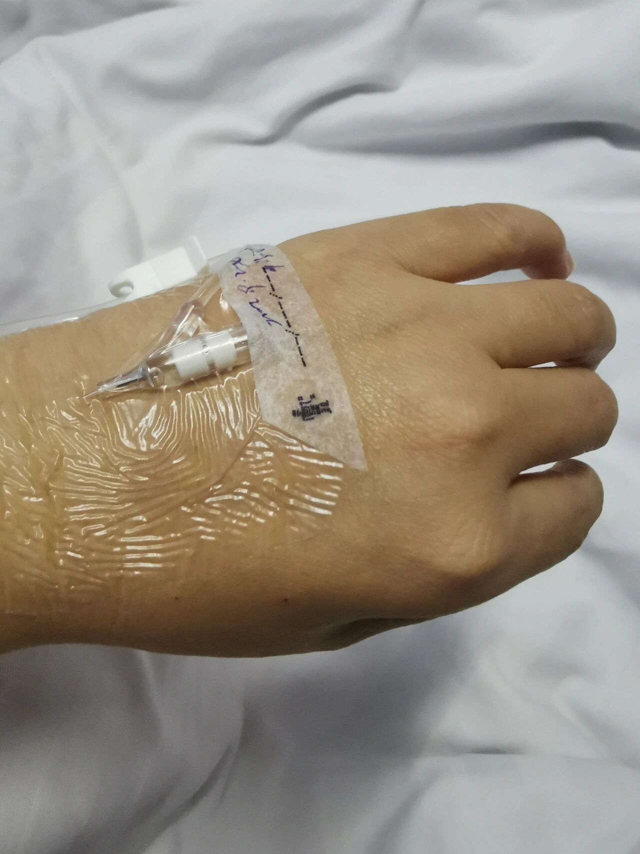 药物性肝损伤要多久才恢复啊 貌似有点点白回来了,不那么黄了.