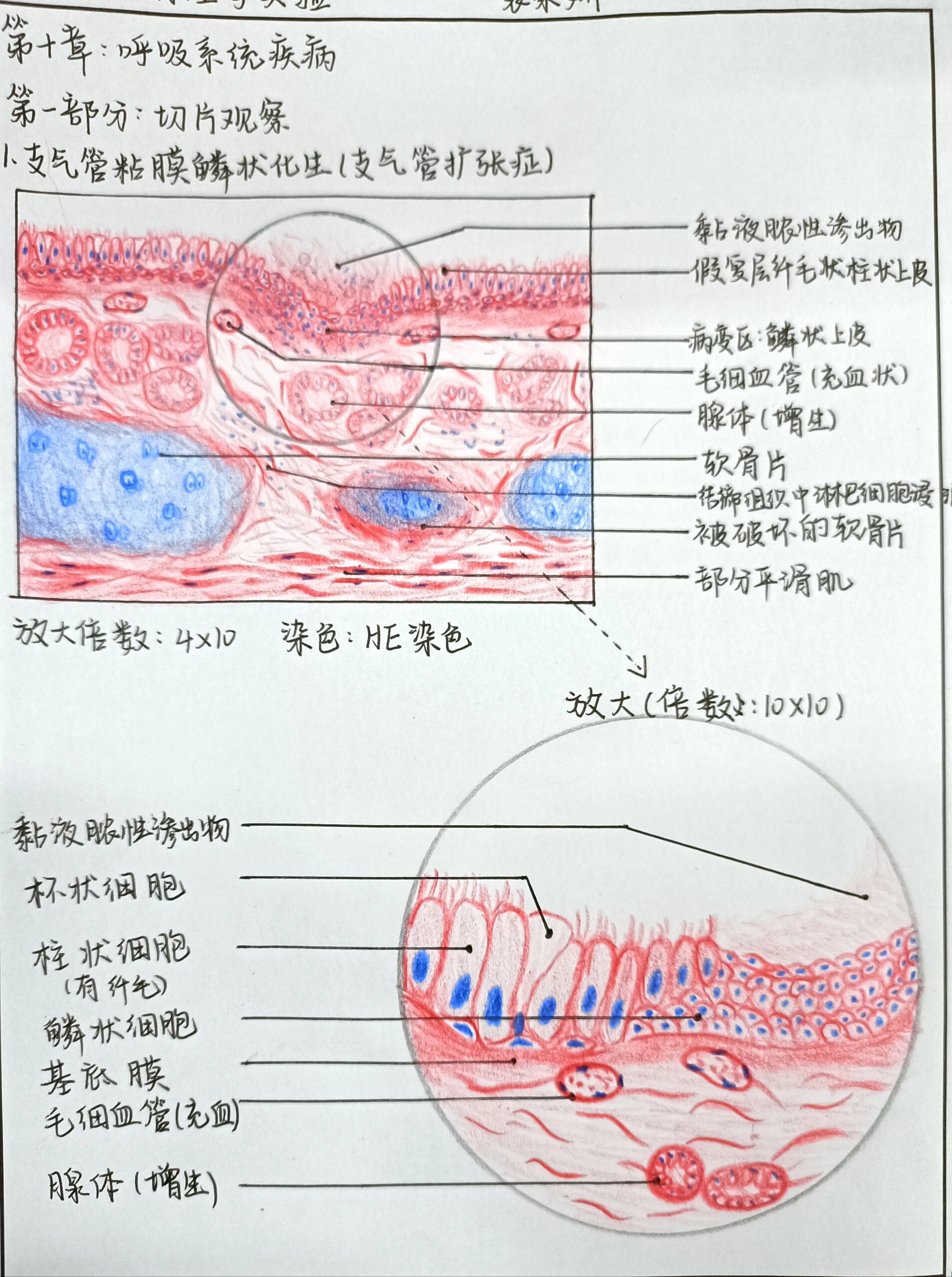 变移上皮切片手绘图图片