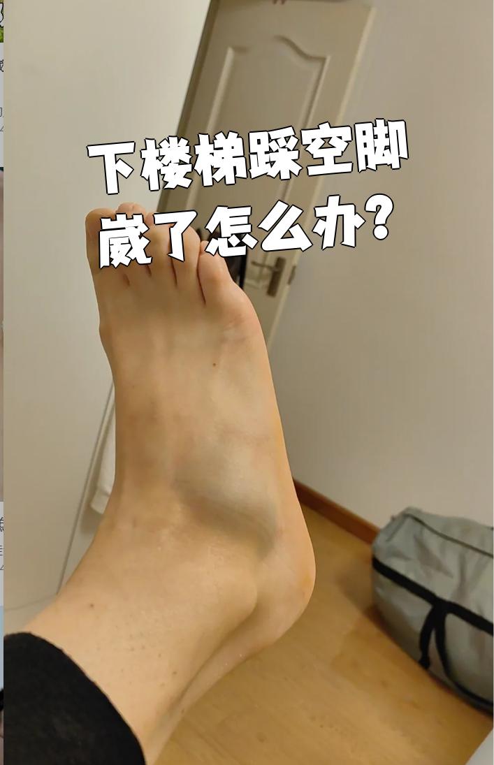 下楼梯踩空崴脚后,先去医院检查有没有骨折或韧带撕裂