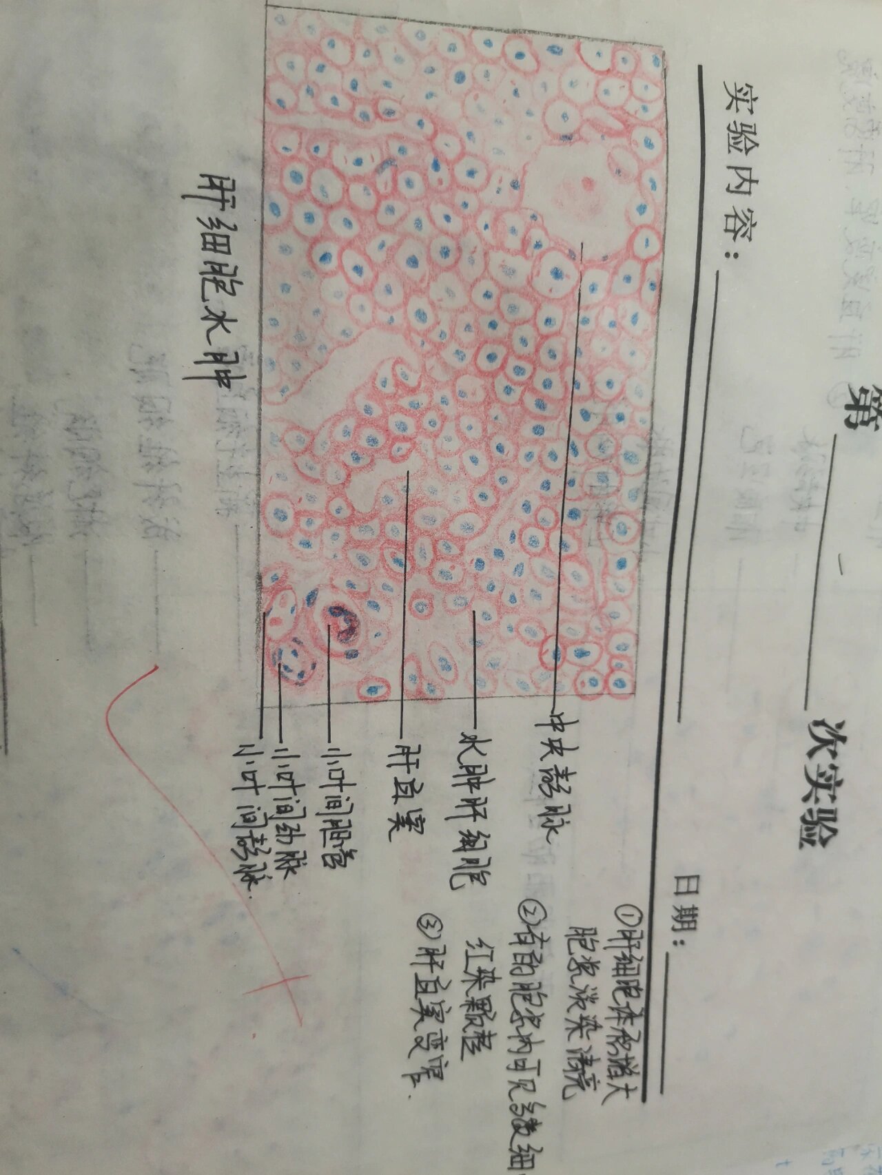 肺脓肿病理切片绘图图片