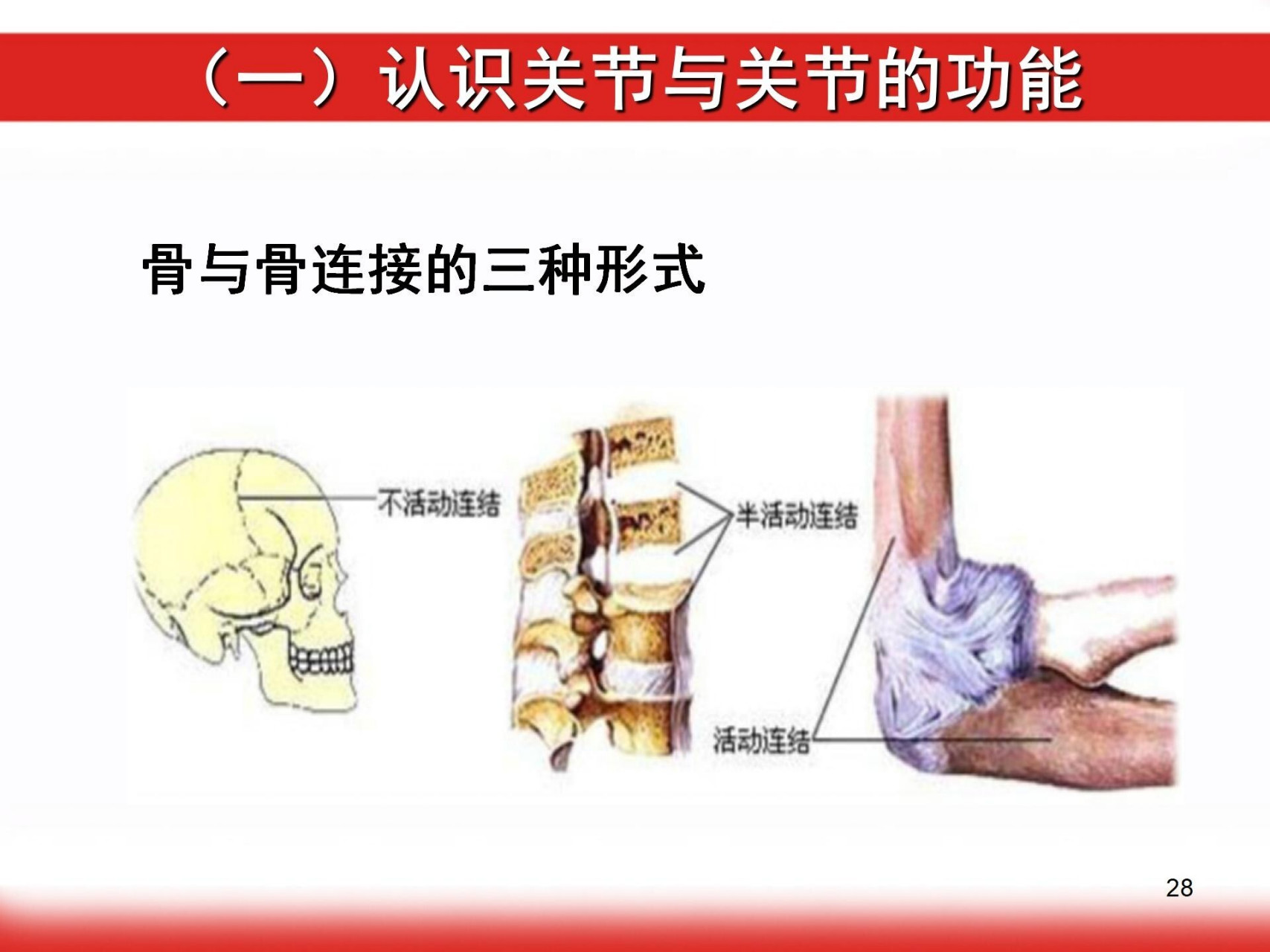 骨桥形成图片