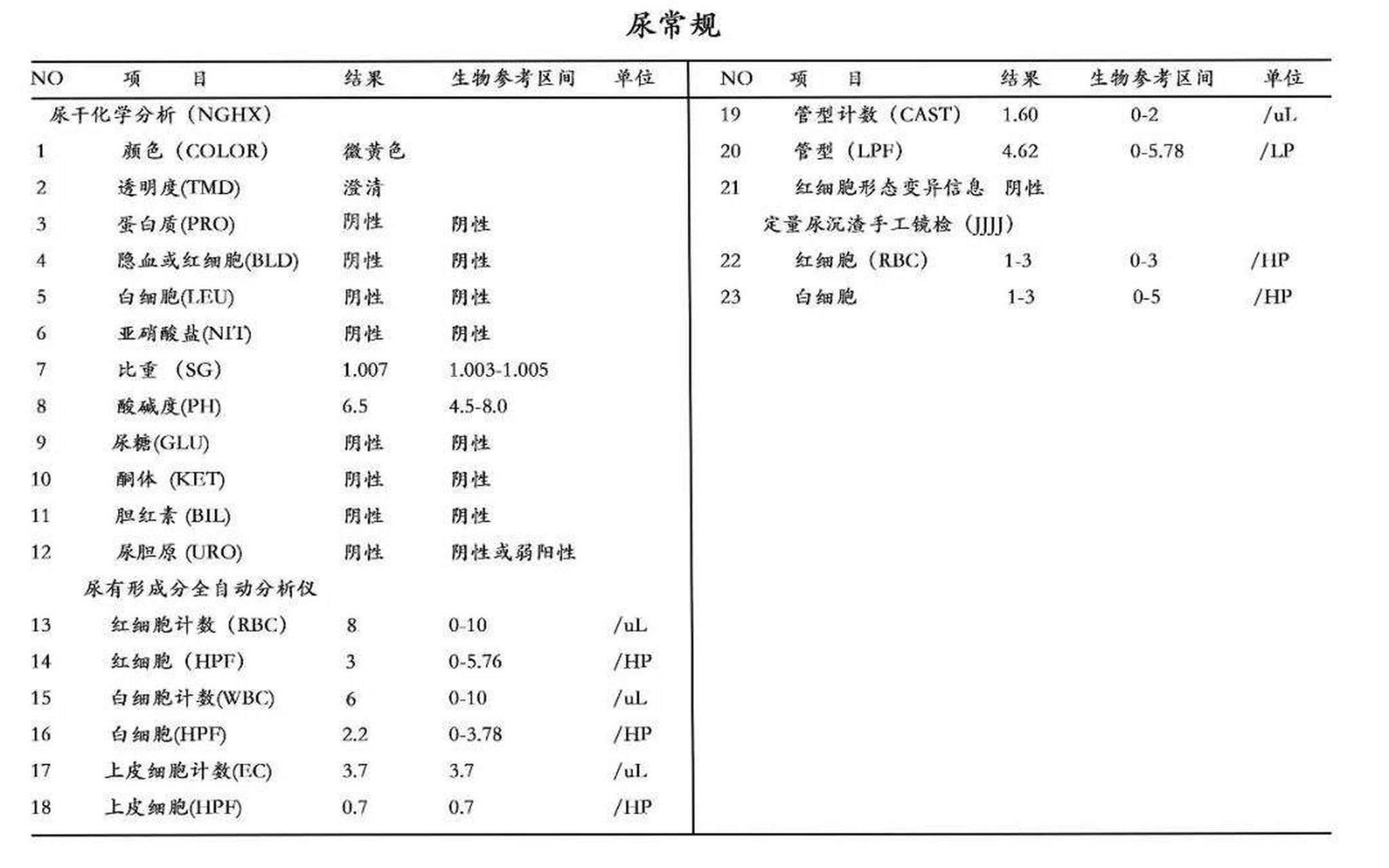 尿常规指标如何看,看看是否有异常 很多人不知道尿常规指标怎么看 今