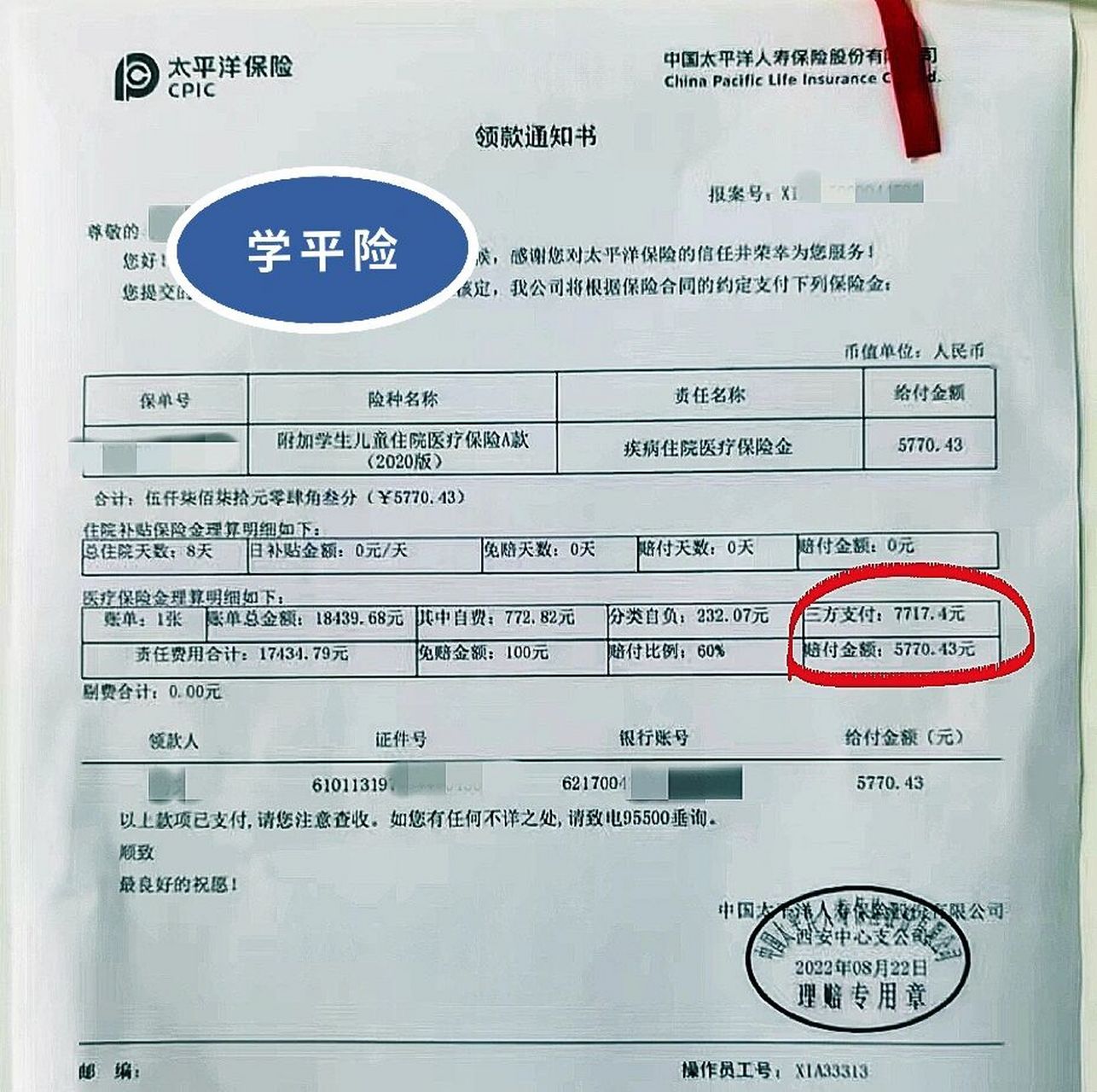 50元的学平险居然报销了5770元 双侧扁桃体切除77腺样体等离子射频