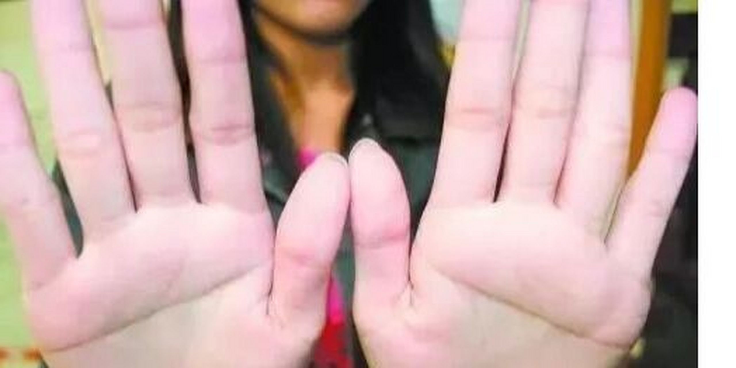 女人双断掌 女人双断掌 若女性双断掌,则个性强势,婚后不讨男人欢喜