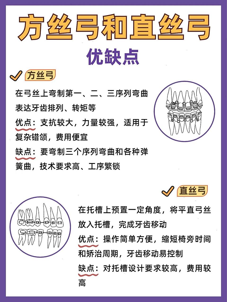 方丝弓和直丝弓 优缺点 方丝弓 在弓丝上弯制第