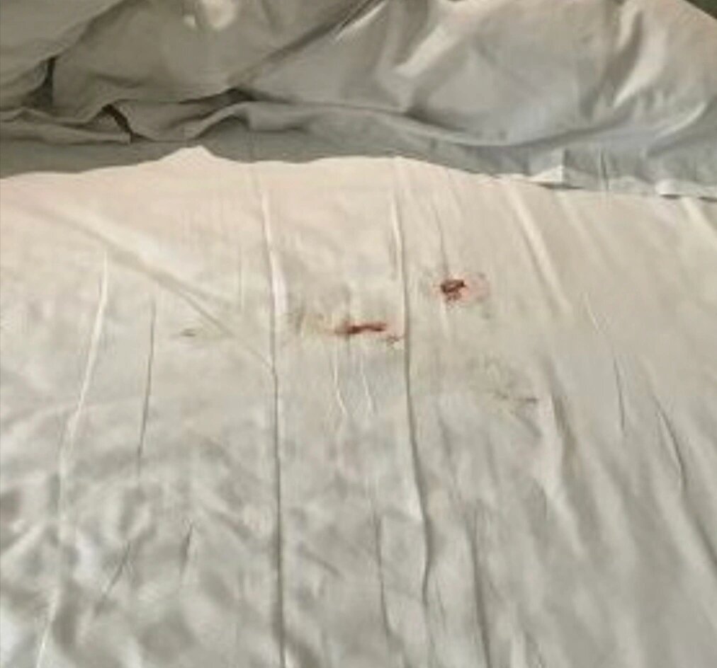 酒店床单快速去除姨妈血,亲测十分有效