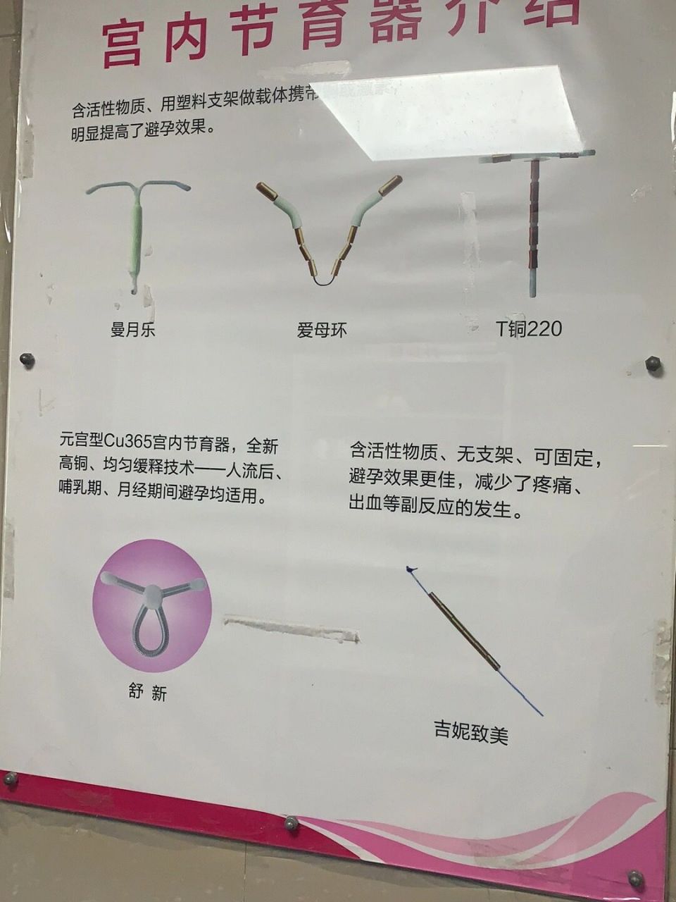 宫腔镜上环图片图片