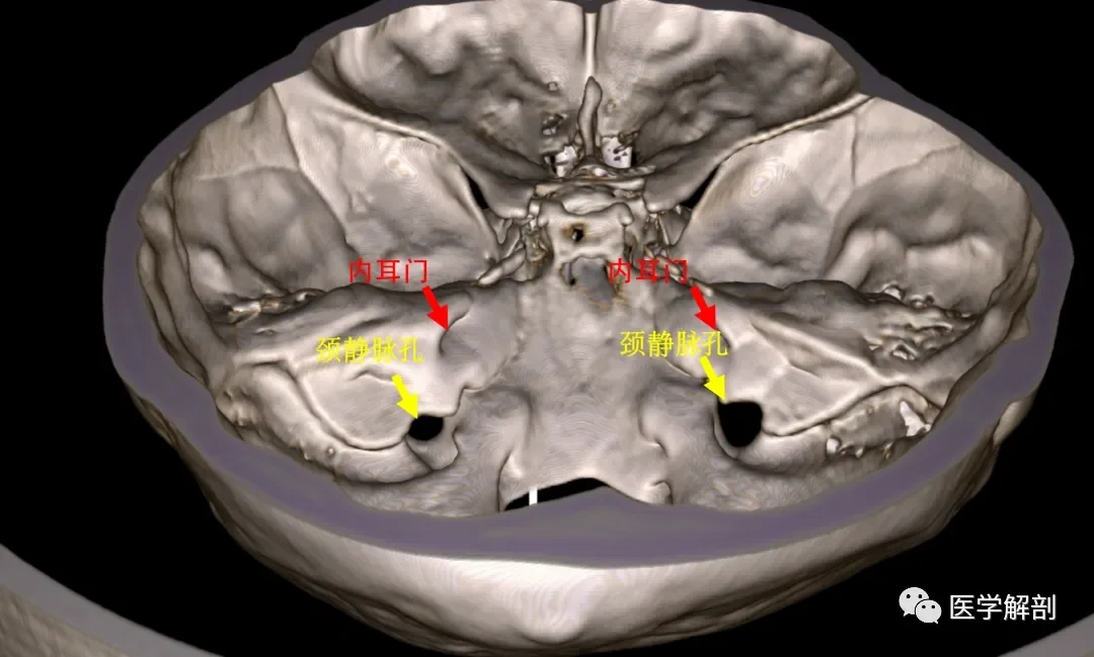颅后窝 我们再看后窝,后窝有个最突出的特点,就是窝底有个大孔,叫枕大