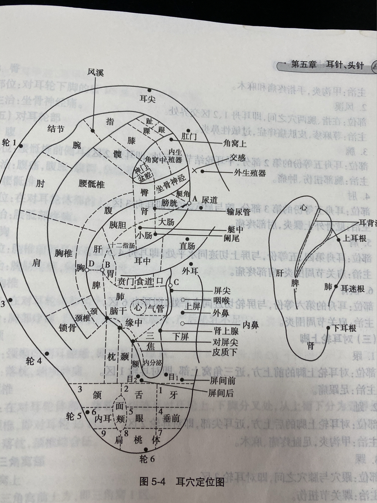 五行针减肥位置图图片