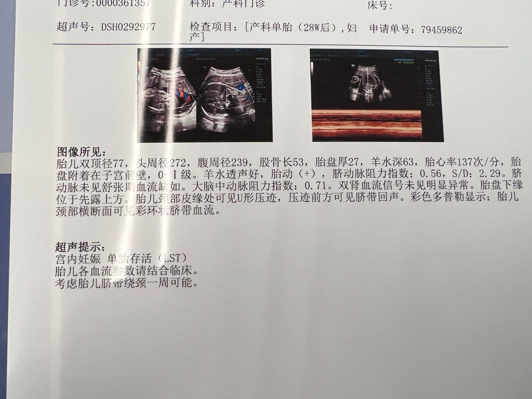 28周 2  双顶径77 谁家宝宝28周长这么大的头啊,医生说差不多是31周的