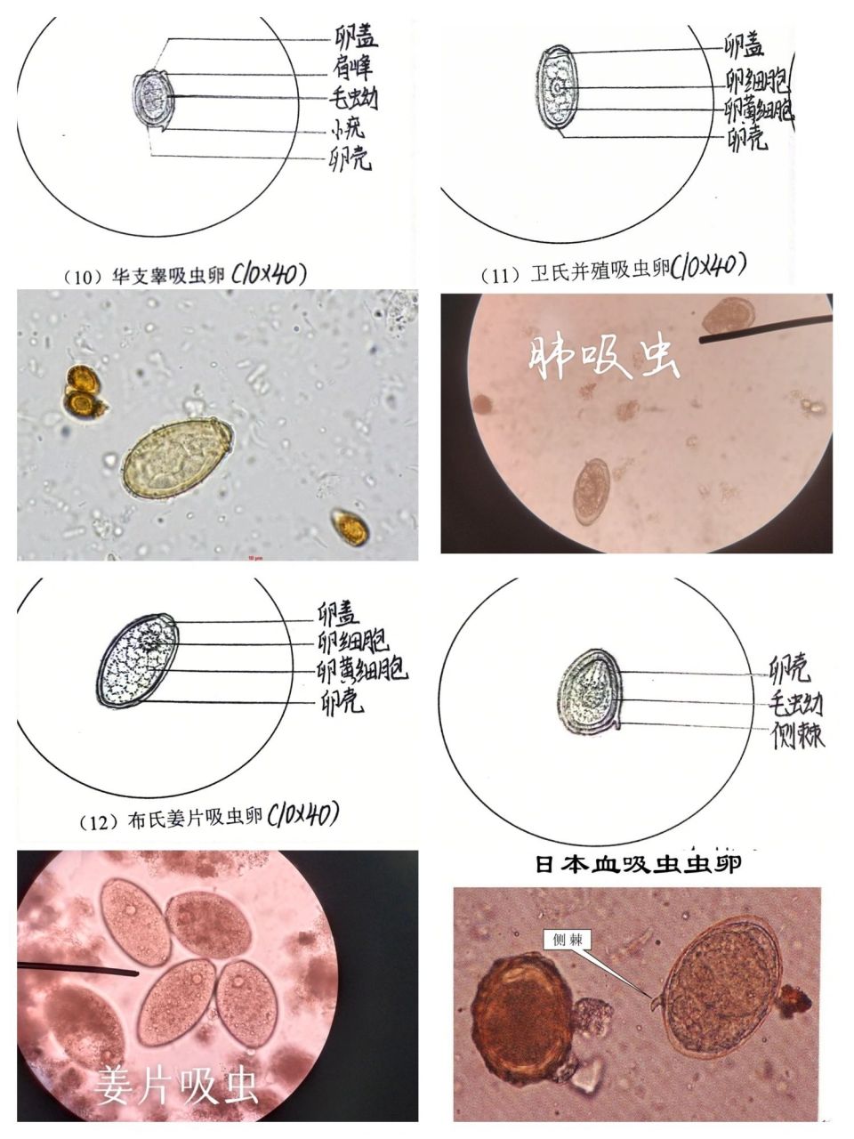 日本血吸虫卵手绘图片