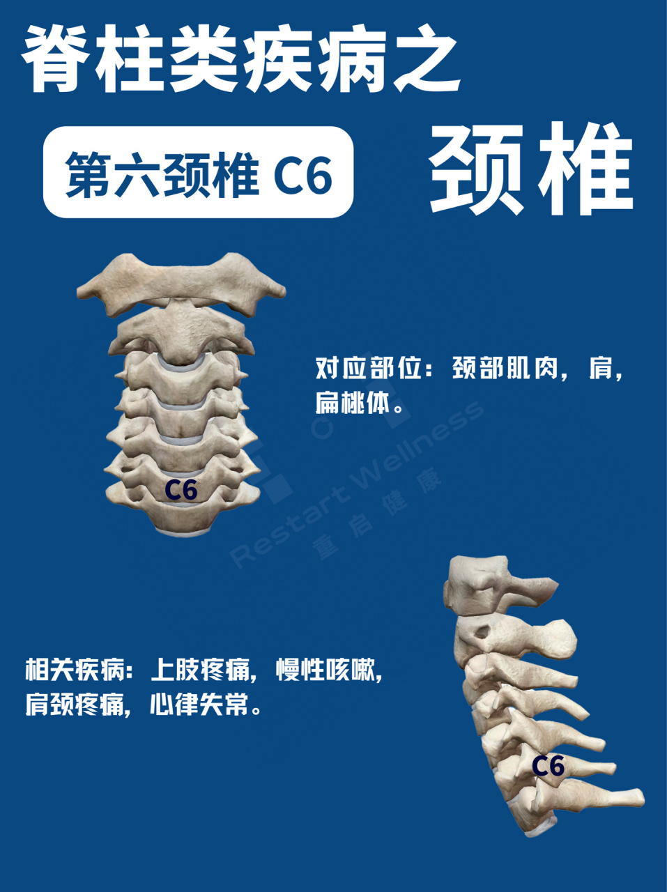 颈椎c5c6c7位置图片图片
