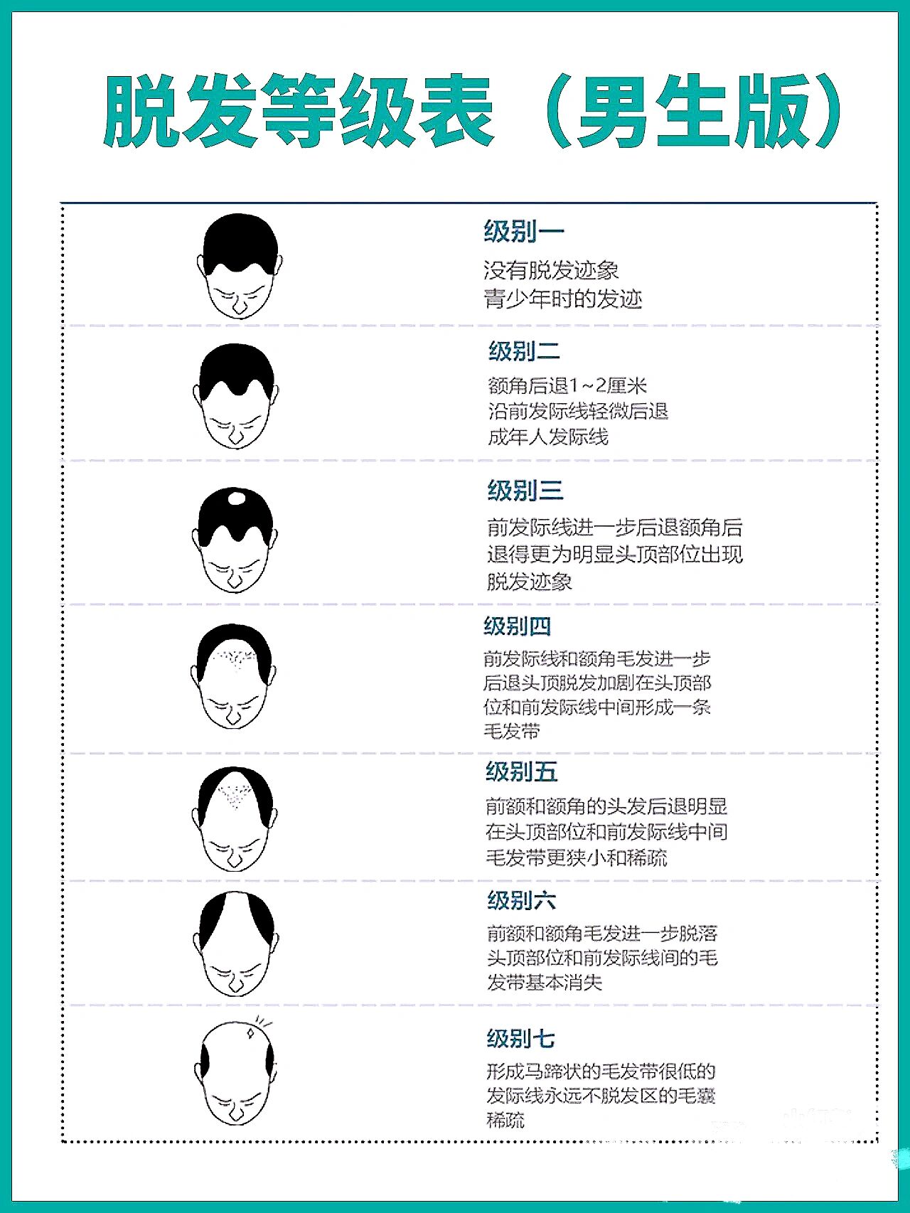 97脱发的等级划分 一级:发迹线正常