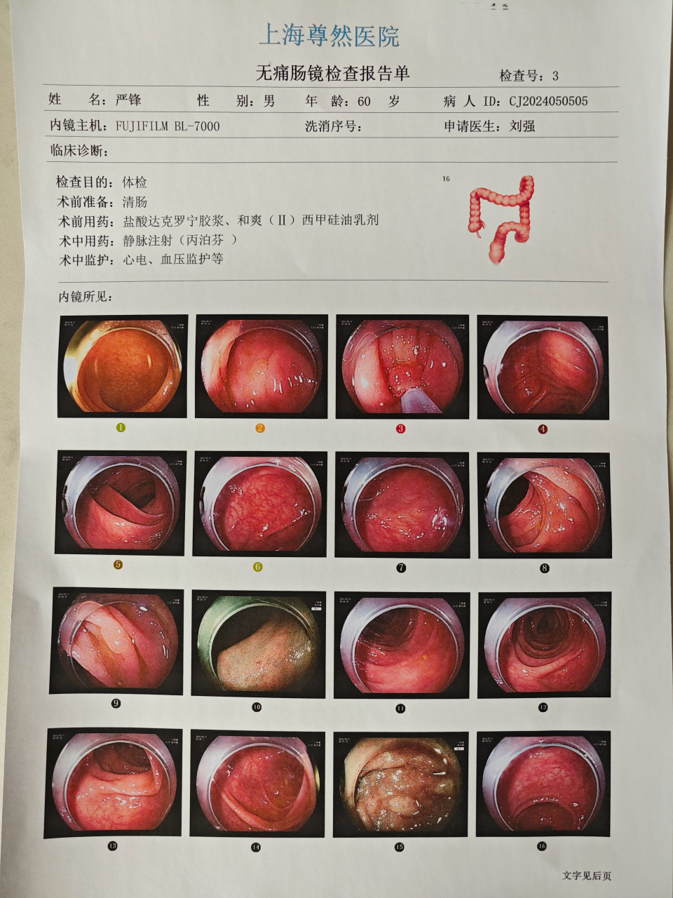 肠镜正常结果图片图片