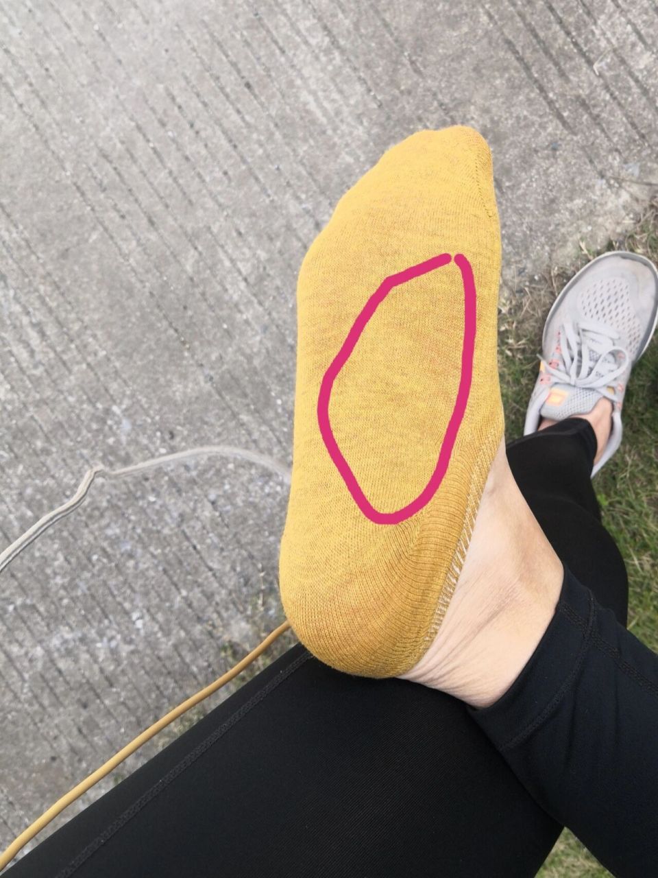 跳绳脚底这里感觉有个筋扯着疼是怎么回事啊 感觉不是次次都会疼,但是