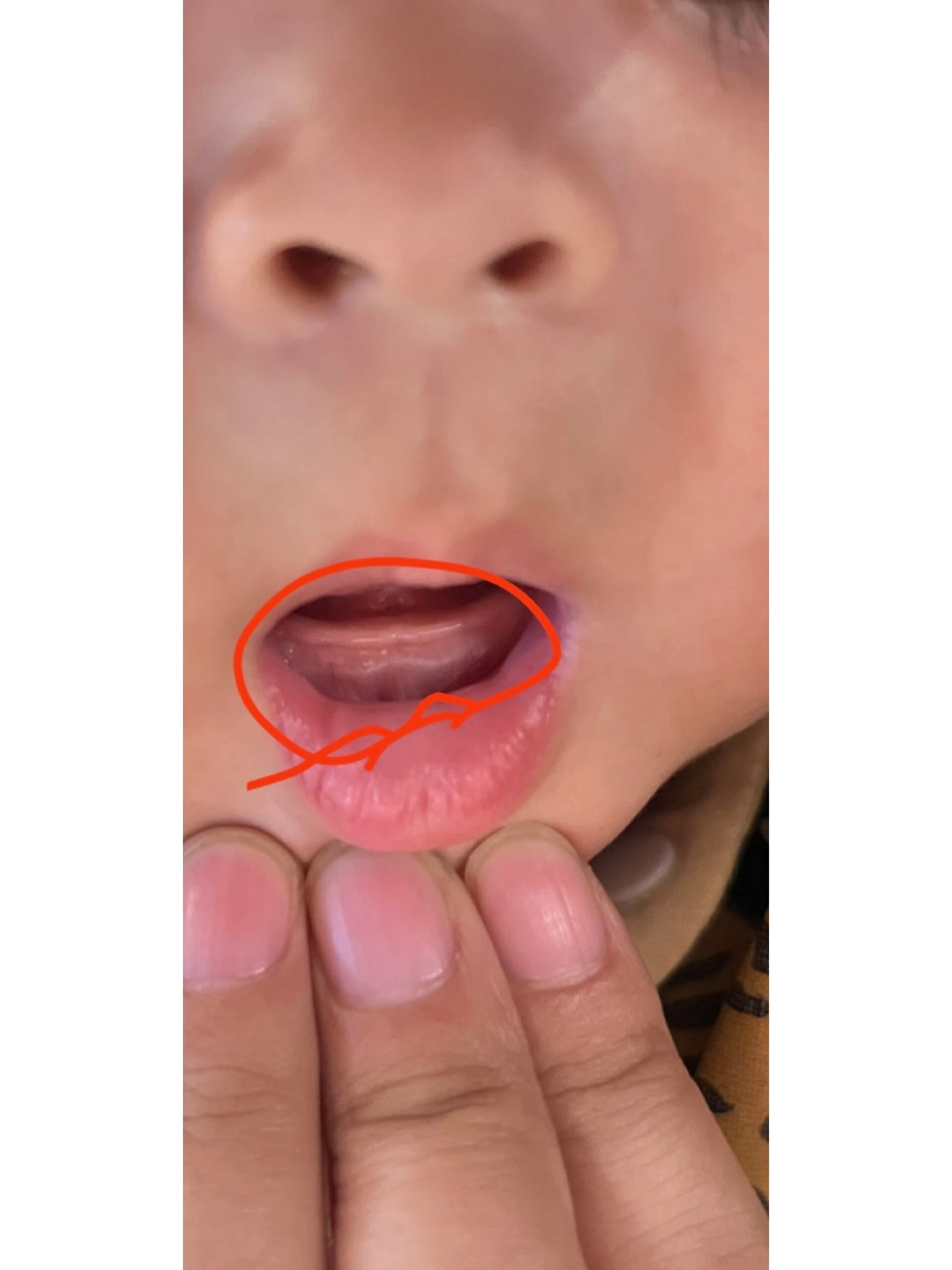 五个月宝宝牙龈位置发白是咋回事