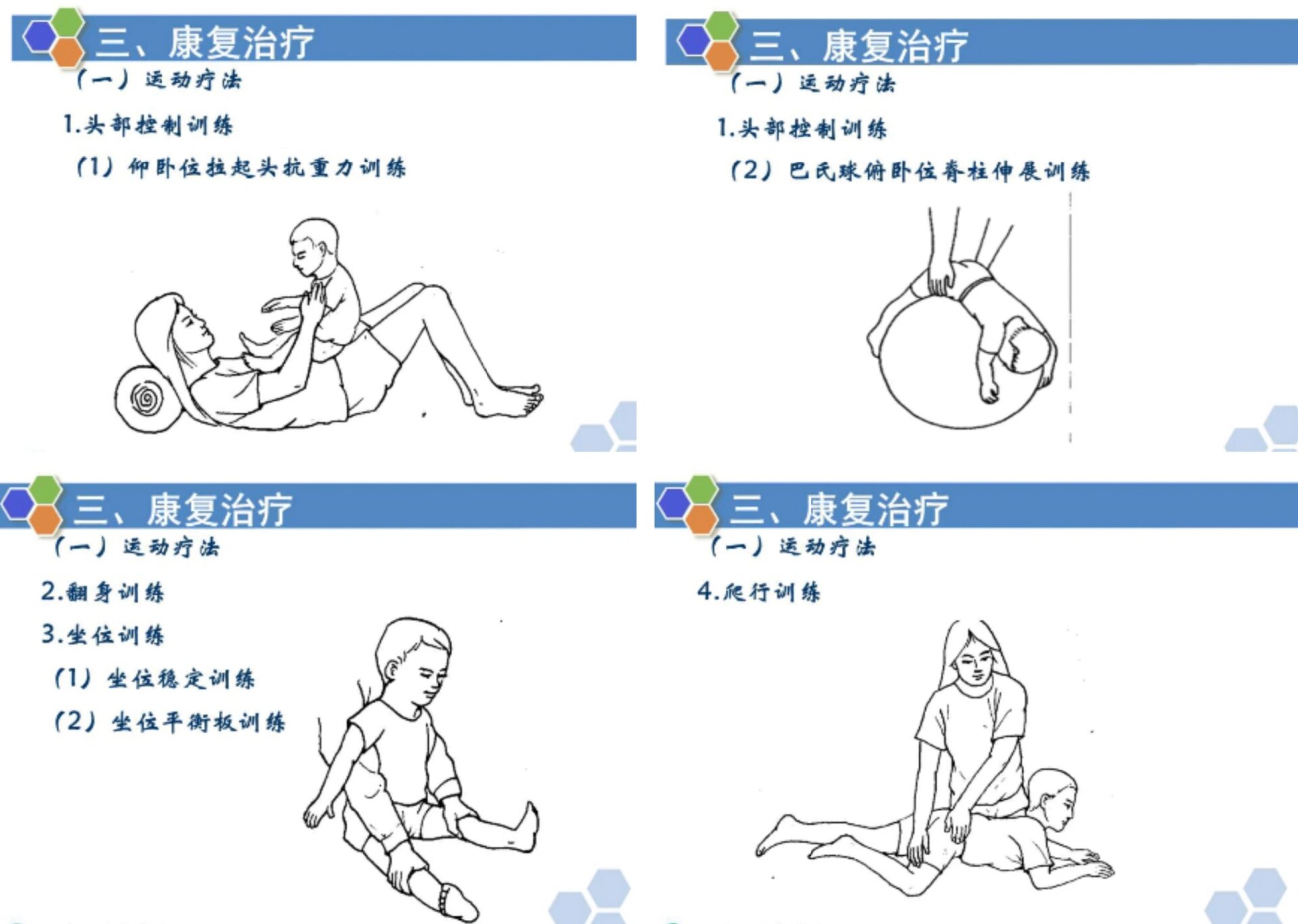小儿脑瘫的康复评定与治疗 小儿脑瘫的评定与治疗