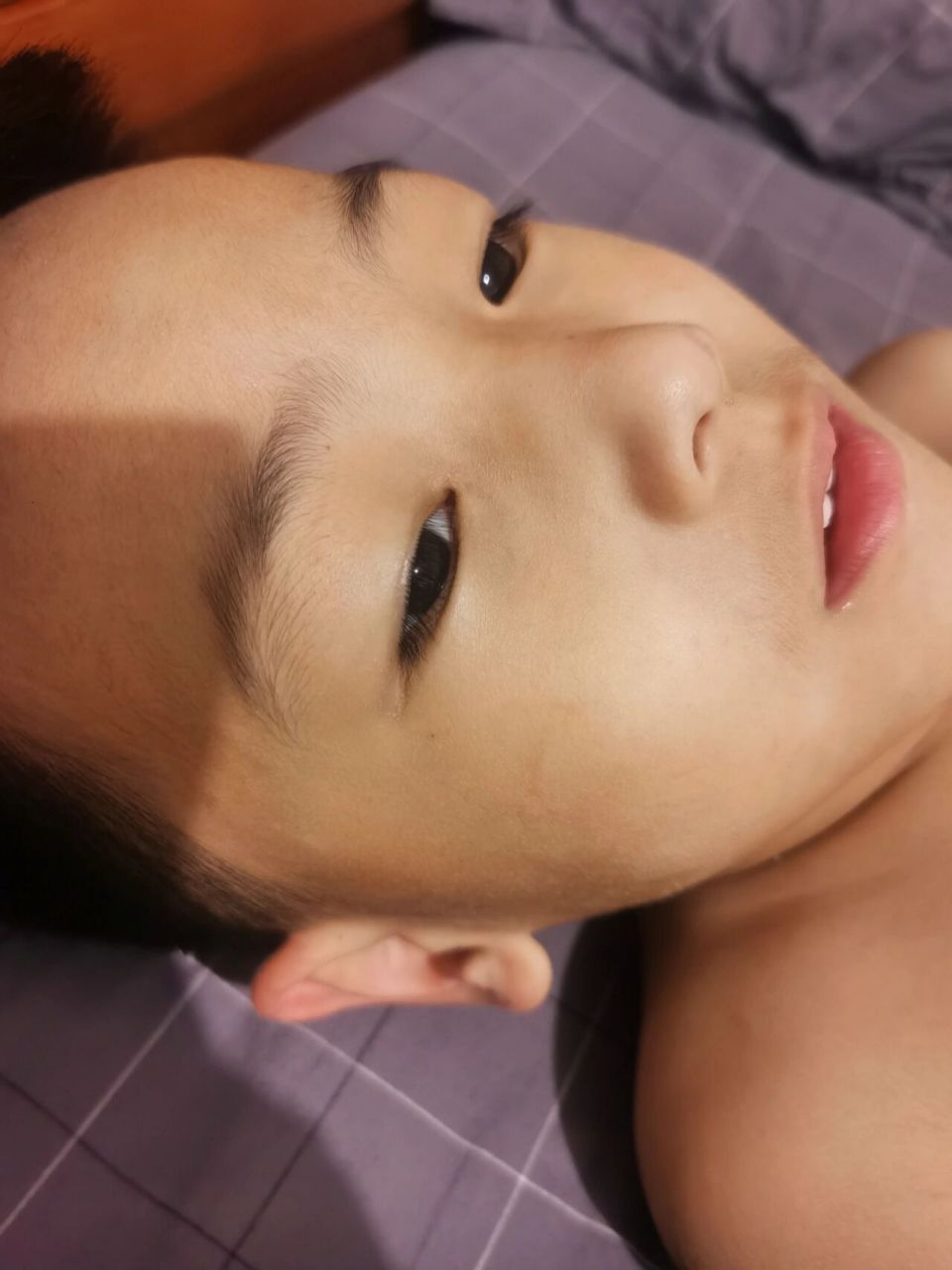 泪囊瘘术后4个月 儿子不是特别同意我拍,这么大自尊心还是比较强的