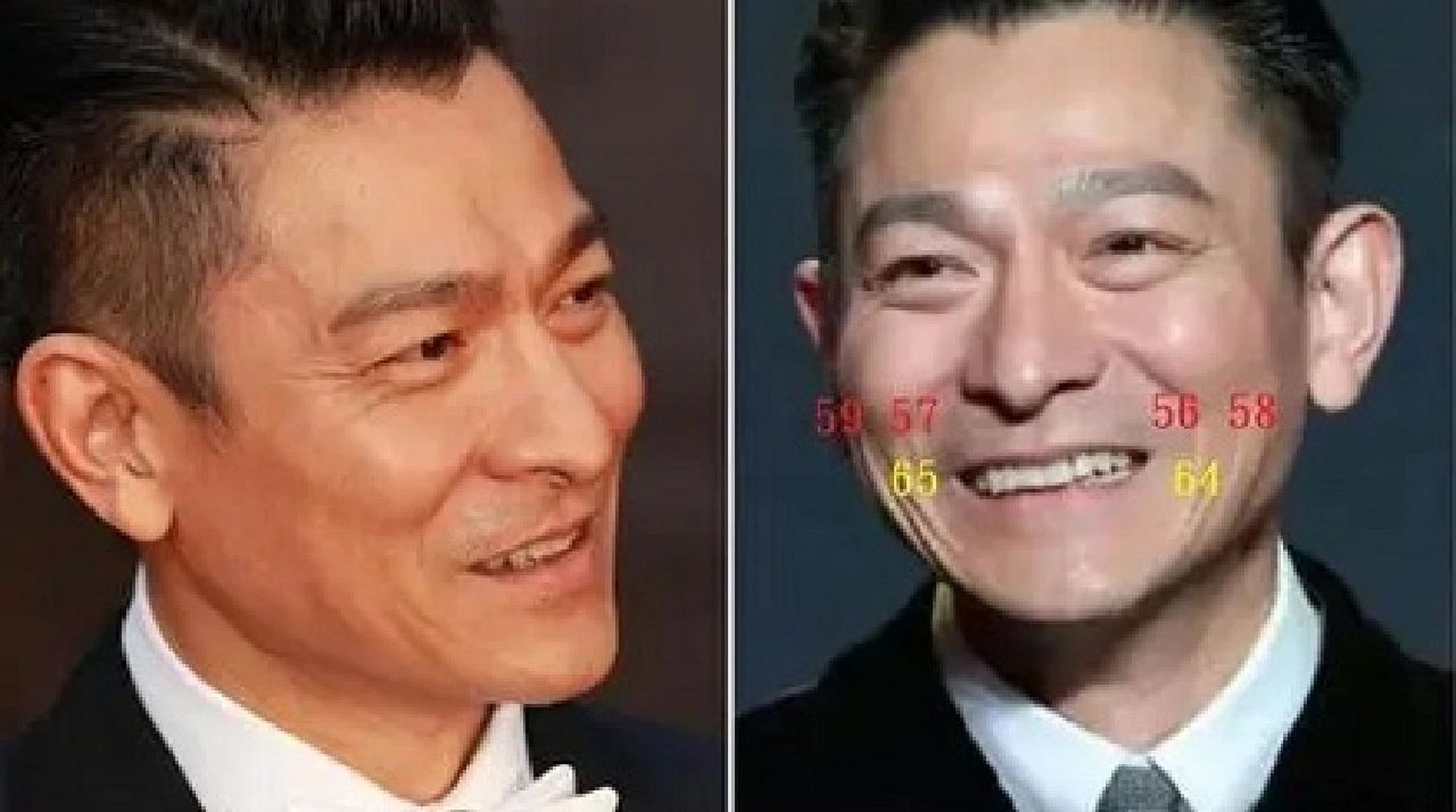 你知道"捧场纹"吗 在相学中也有一种纹路叫"捧场纹",它是脸颊两侧的纹