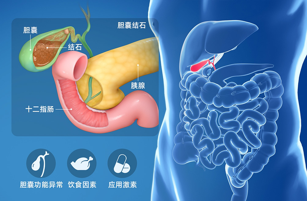 胆结石在身体的位置图图片