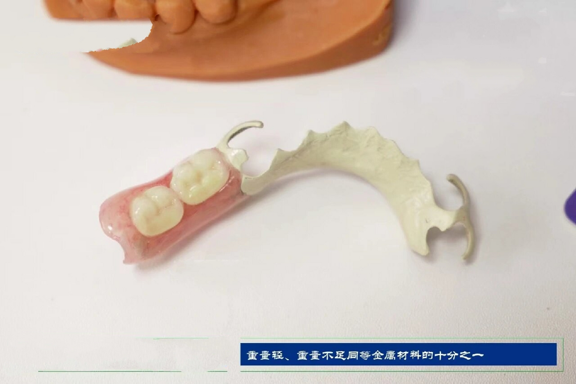 德国hpp支架 无金属 佩戴自然,轻松 可做核磁共振