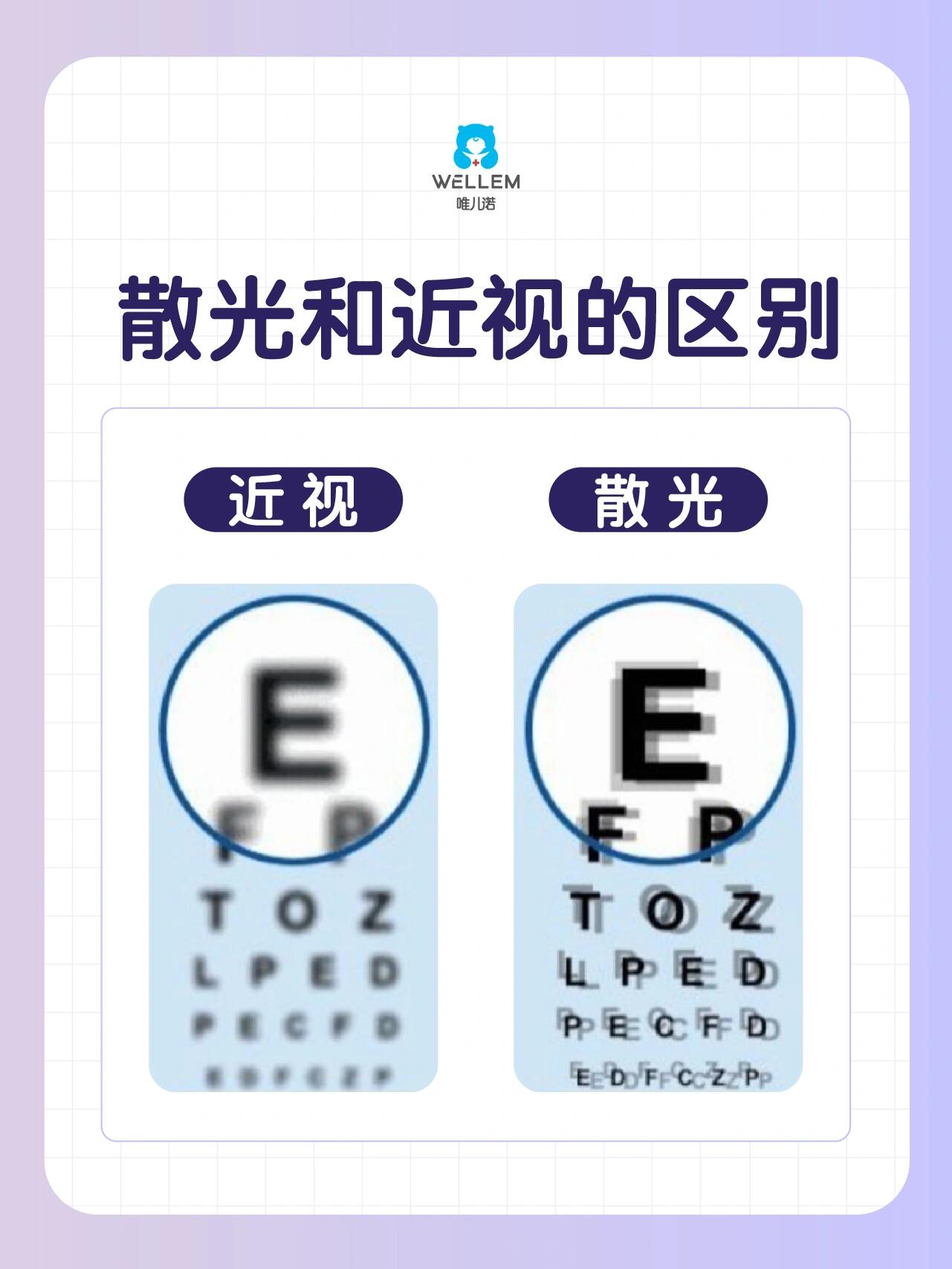 如何判断有没有散光?