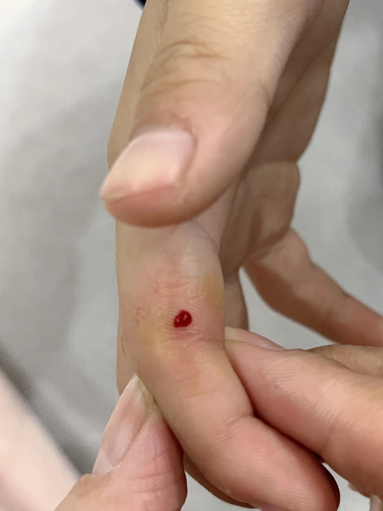 被仓鼠咬了~五针疫苗😭