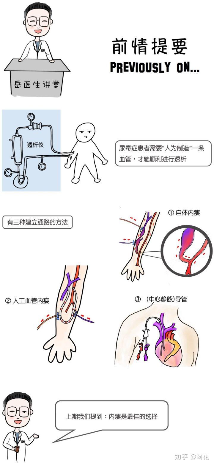 血透造瘘图片