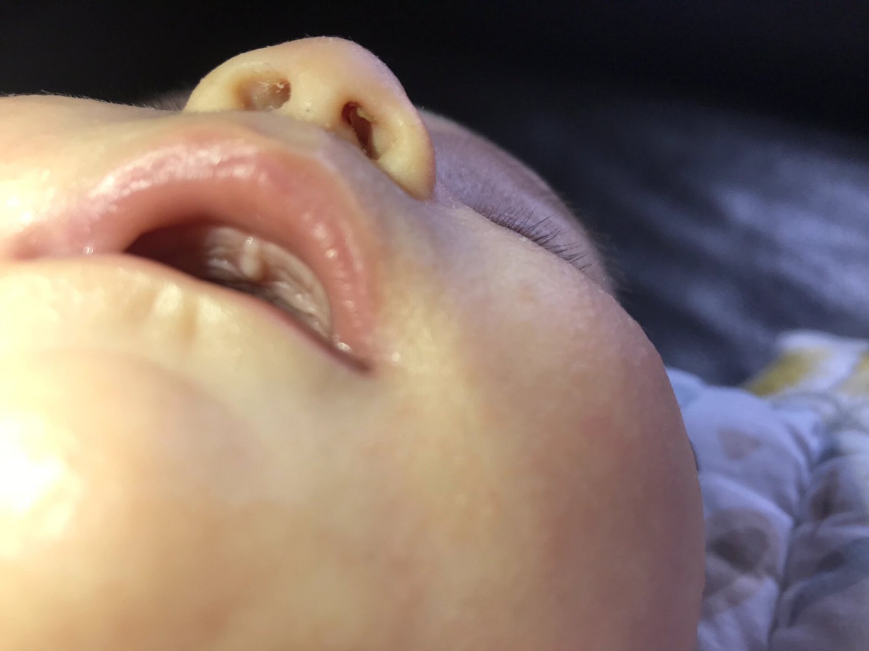 求助各位宝妈, 宝宝上颚白色的一块是什么?