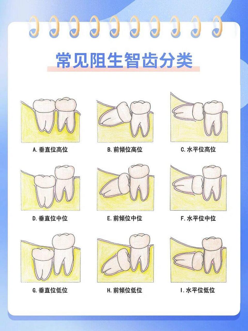 拔智齿恢复过程图解图片