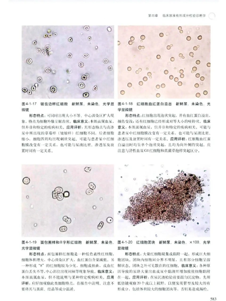 尿红细胞位相正常值图片