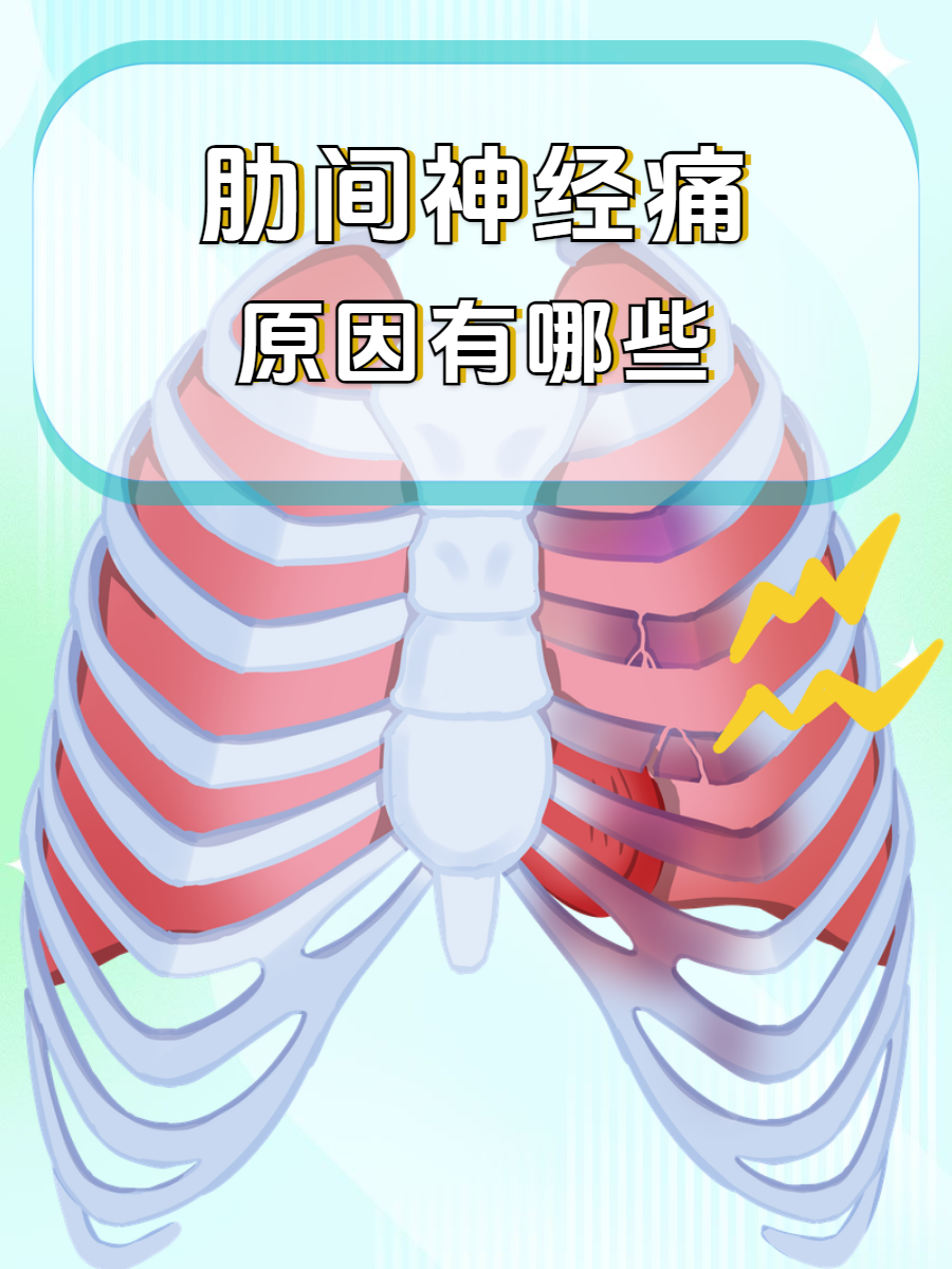肋间神经痛的原因有哪些?