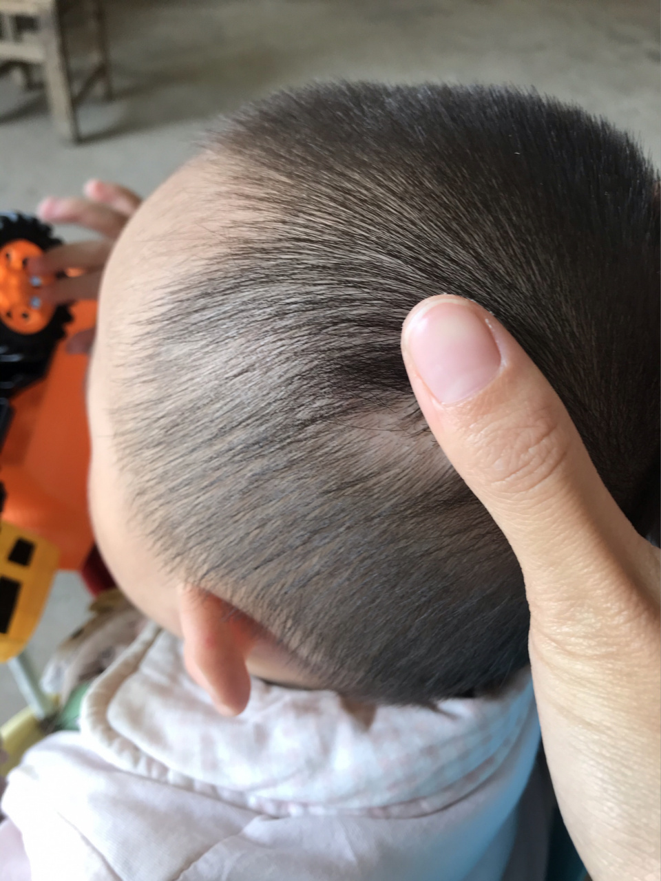 真的是后悔死我了,第一次摔伤,想抽自己两巴掌!