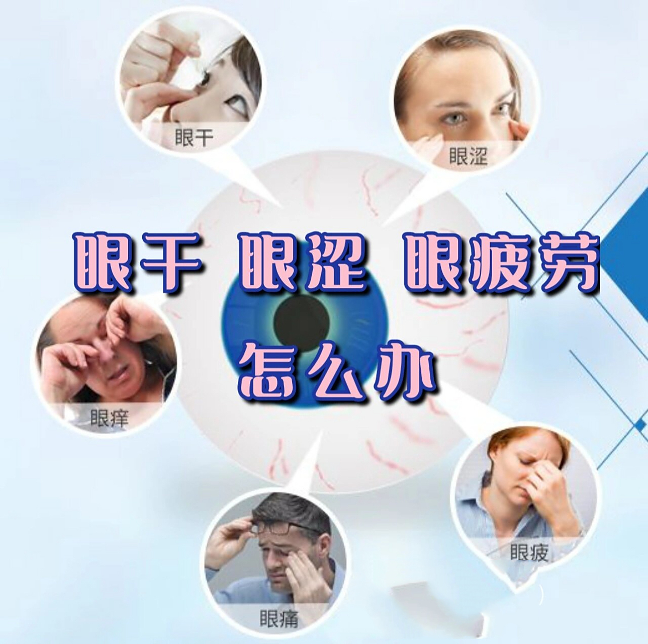 眼干,眼涩,眼疲劳,怎么办?