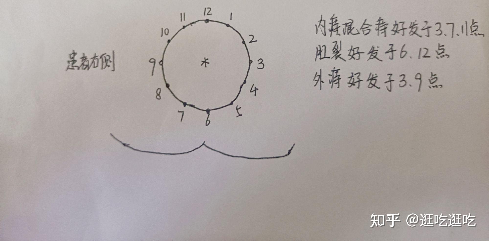 膀胱截石位图片图片