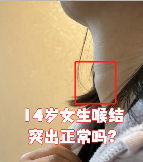 为什么女生有喉结