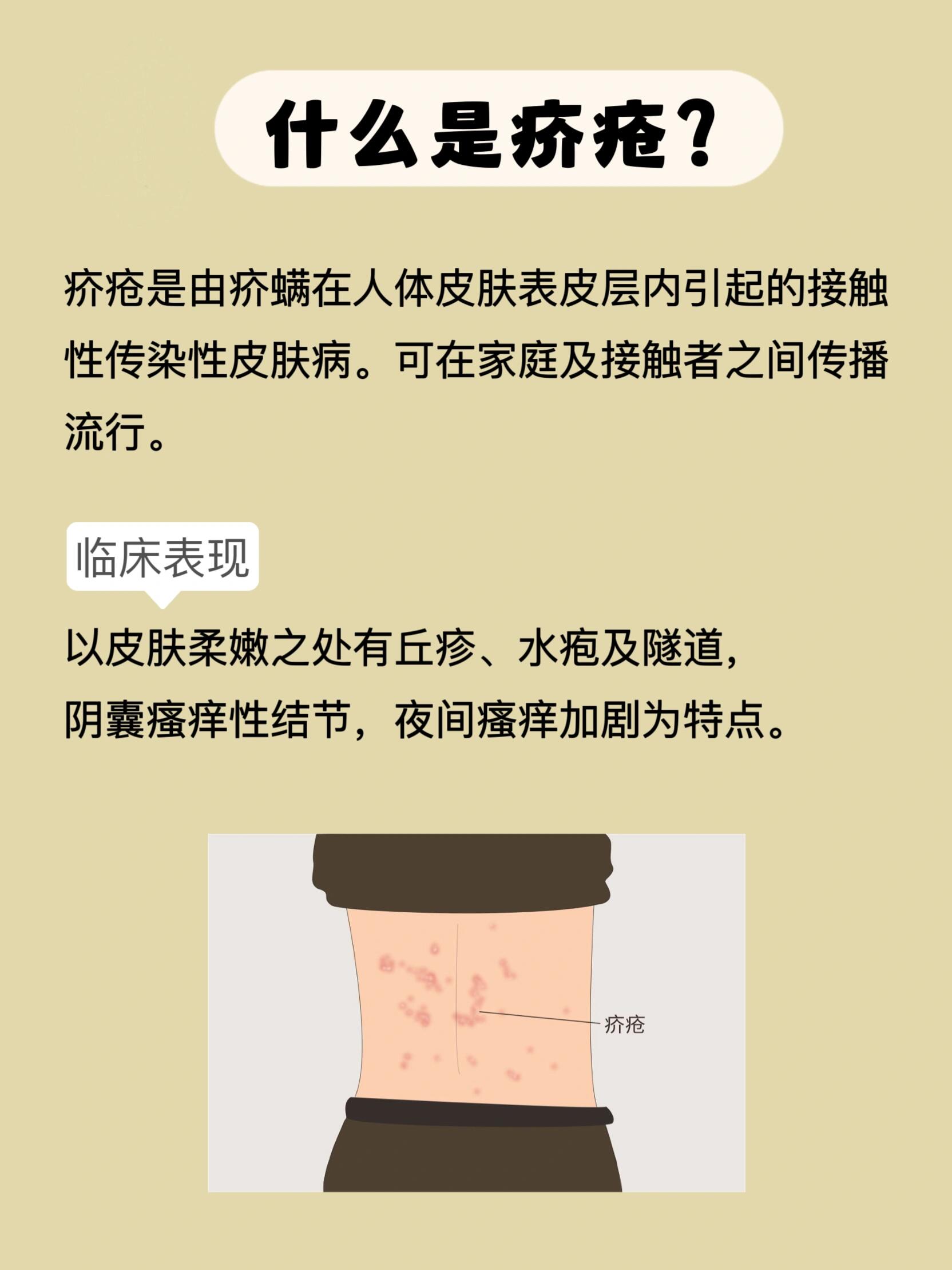 剧烈瘙痒的疥疮是怎么回事,是什么引起的?