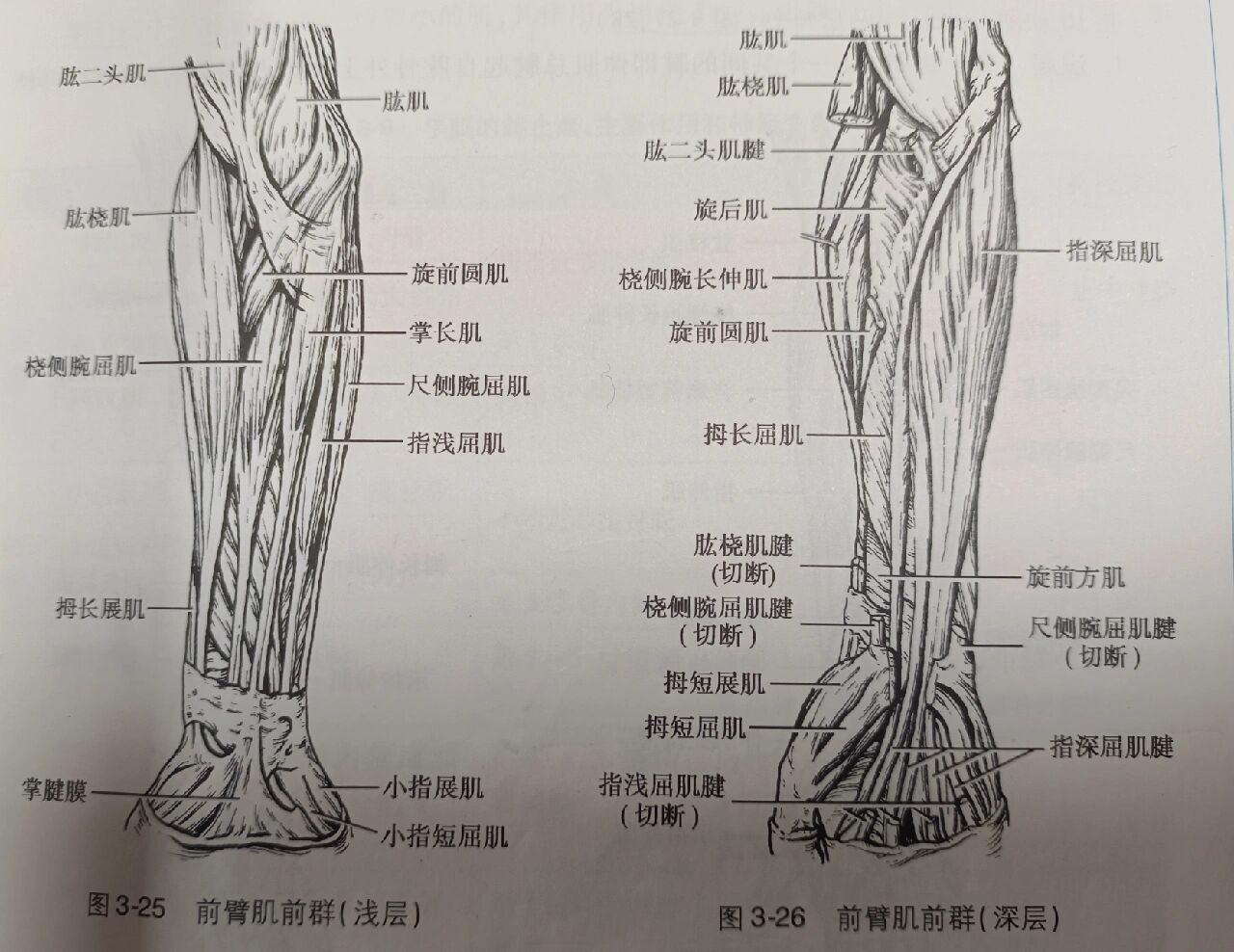 上肢肌肉 94上肢肌肉分为上肢带肌