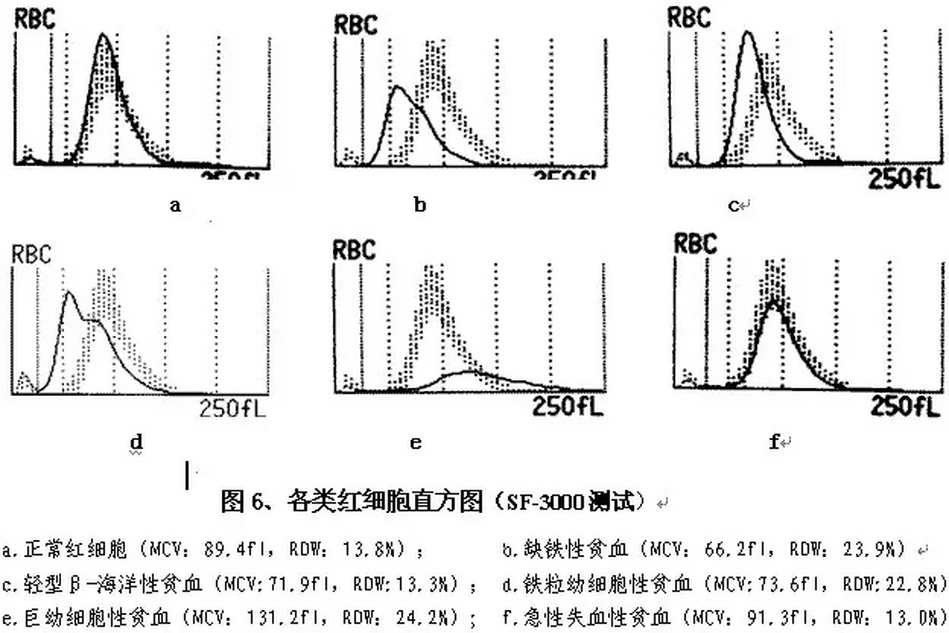 06图二:正常红细胞直方图为近似正态分布的单峰曲线,分布在 36~360