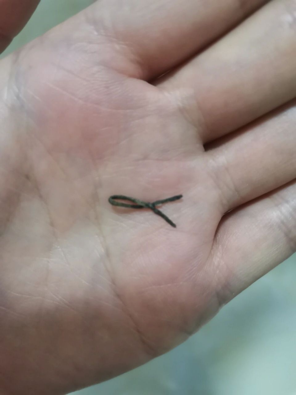 曼月乐环尾丝脱落? 带曼月乐两个月了,昨晚上厕所擦拭.