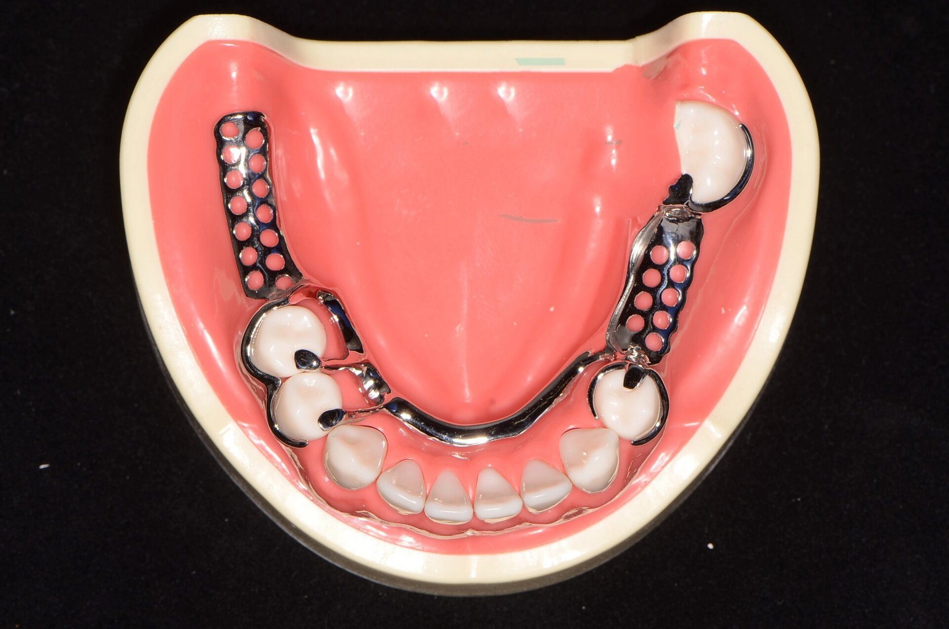 合支托预备和各种卡环 牙合支托凹的制备 制备原则