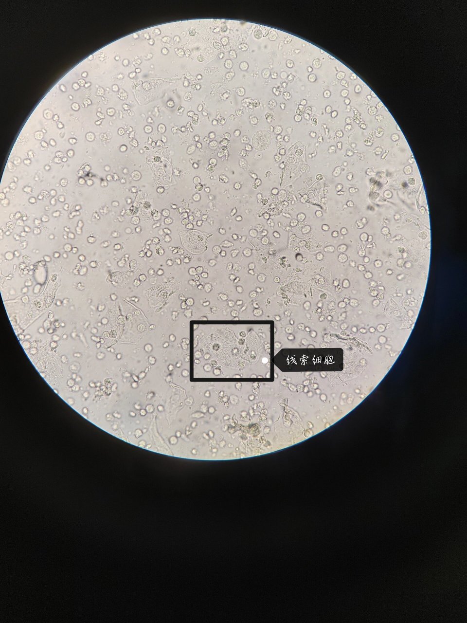 正常白带显微镜下图片图片