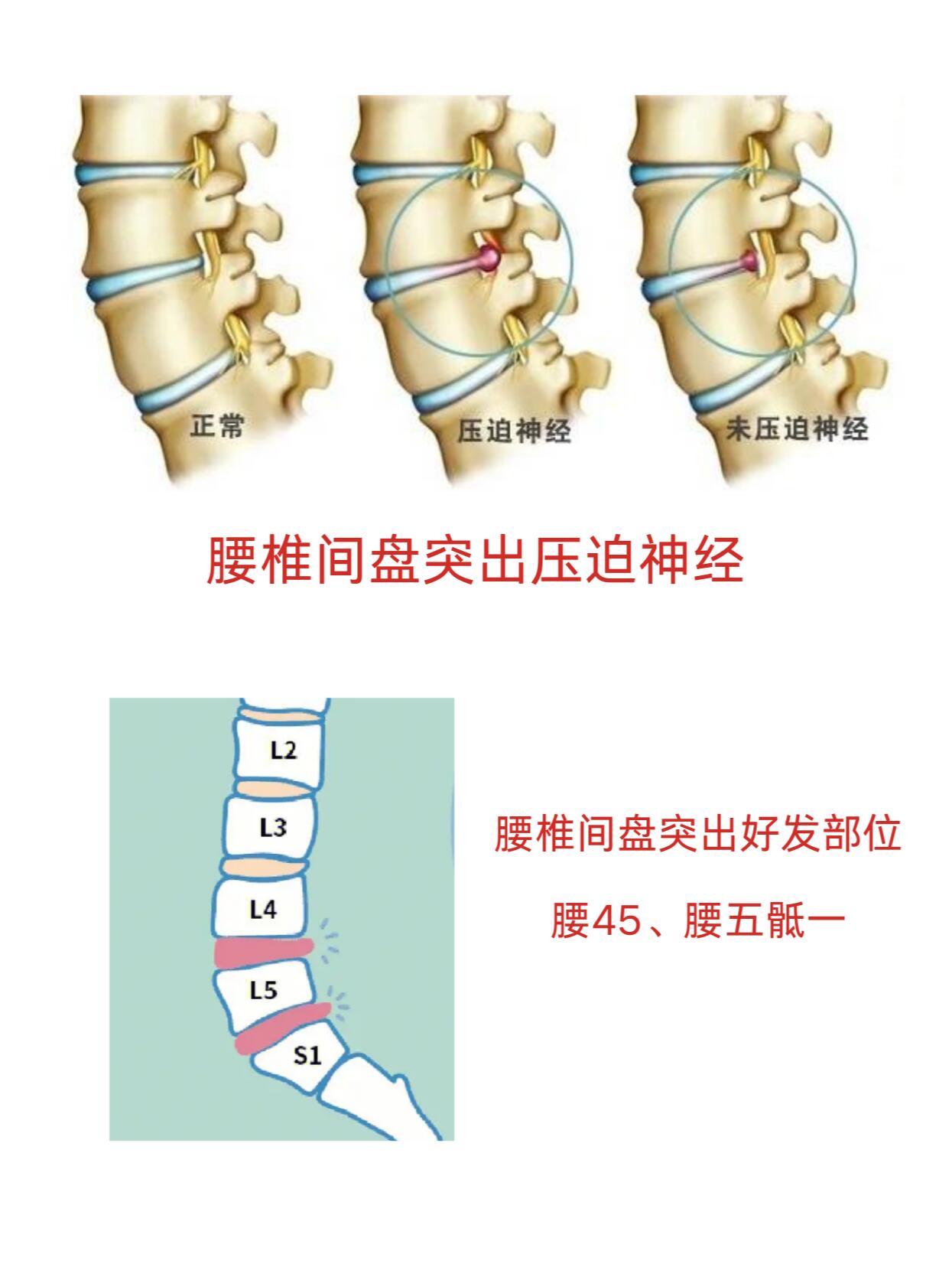 人体腰椎1-5节示意图图片