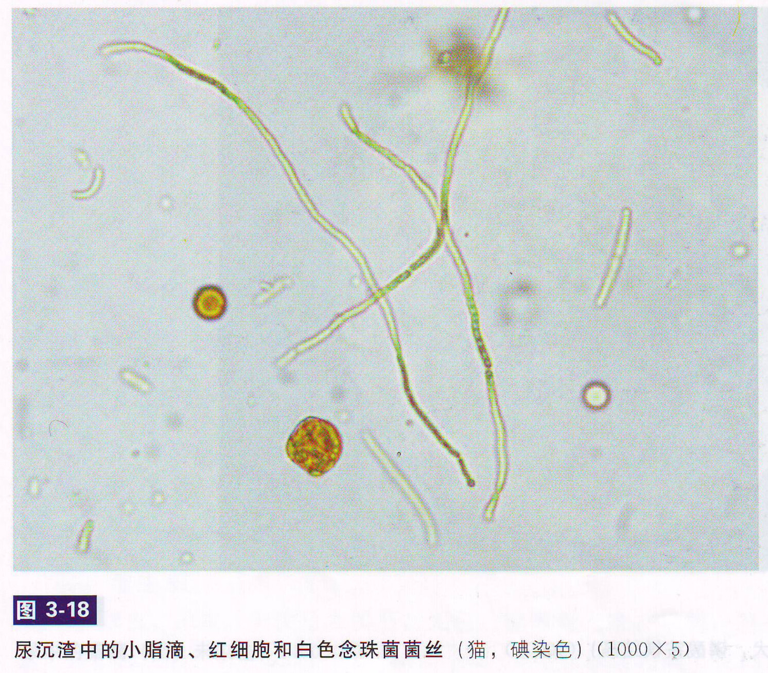 犬尿沉渣管型图片