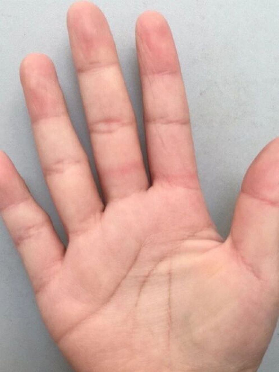 缘主小指下方水星丘有痣,说明你命中有桂人相助,人缘关系很好,加上