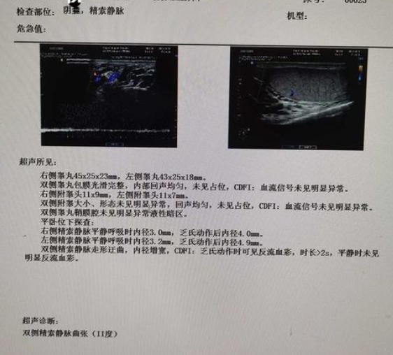 精索静脉曲张3.1mm属于中重度情况,需要重视
