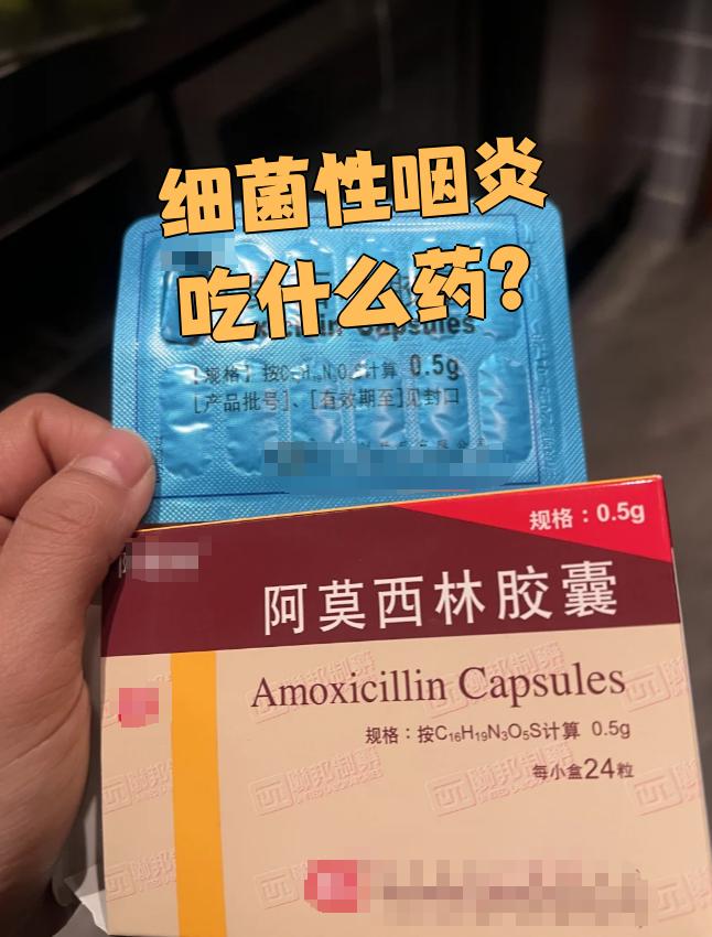  嗓子病毒性发炎是什么引起的症状吃什么药(嗓子发炎吃什么药最快)