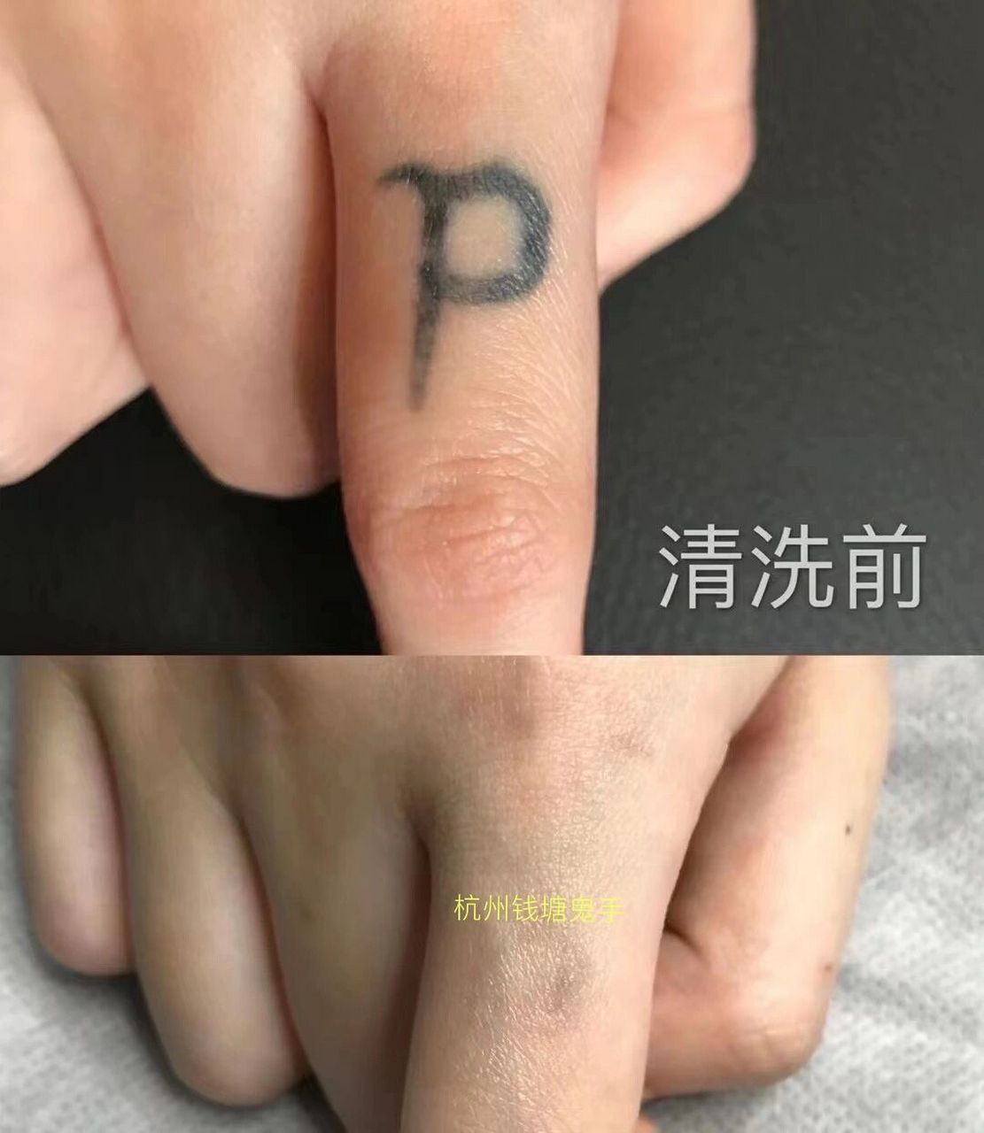 洗纹身其实很简单,方法对了一次就干净 清洗纹身是一个复杂而又漫长的