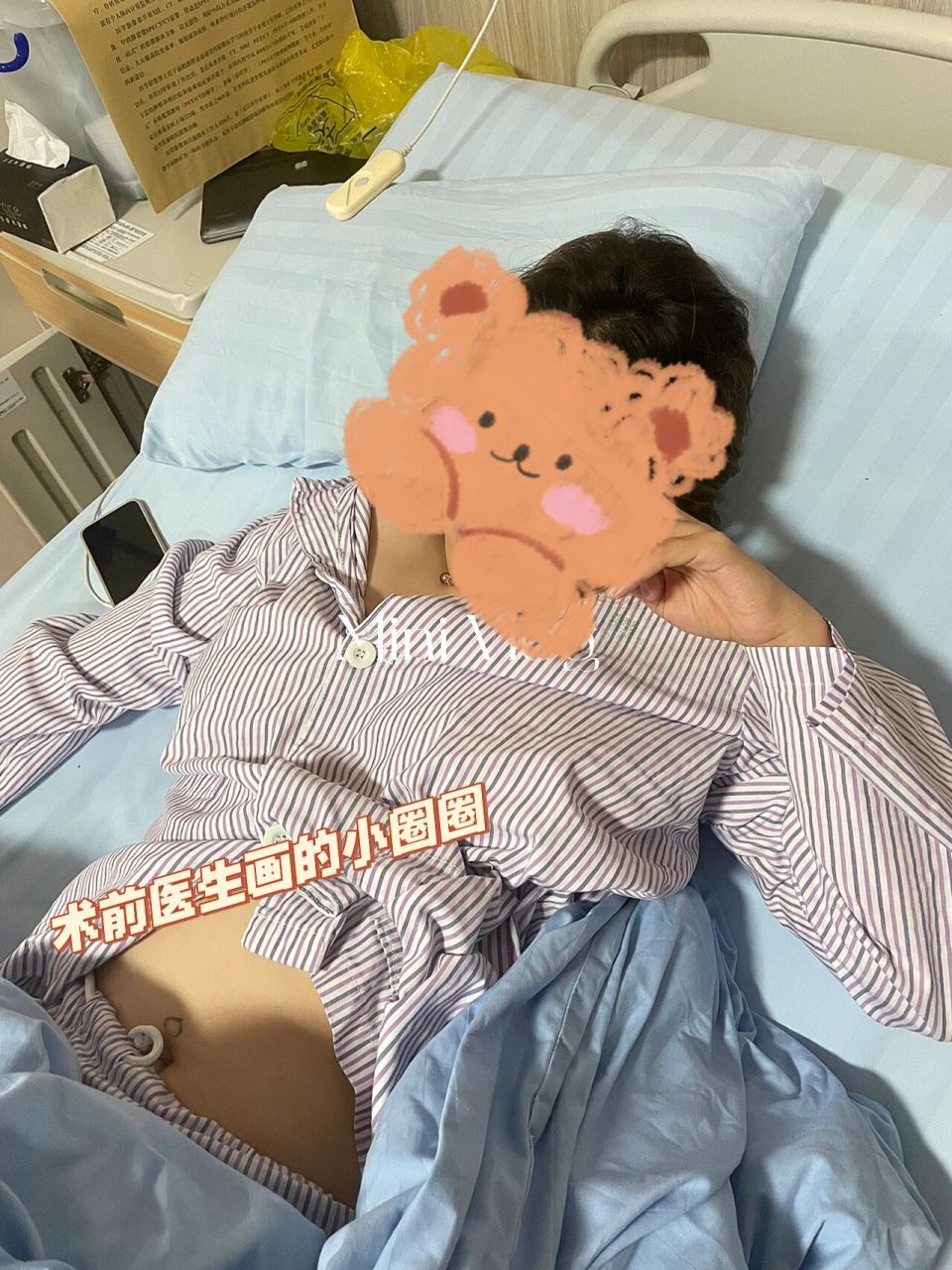 急性阑尾炎日记1 术前 治疗 常见病大病秧子我又来了!